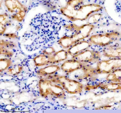 IHC staining of FFPE human kidney tissue with TRAIL-R4 antibody, HRP-secondary and DAB substrate. HIER: boil tissue sections in pH8 EDTA for 20 min and allow to cool before testing.