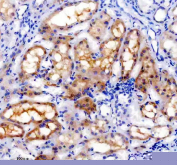 IHC staining of FFPE human kidney tissue with TRAIL-R4 antibody, HRP-secondary and DAB substrate. HIER: boil tissue sections in pH8 EDTA for 20 min and allow to cool before testing.