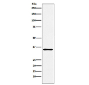 Western blot testing of human prostate tissue lysate with TRAIL-R4 antibody. Predicted molecular weight ~42 kDa.