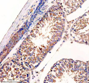 IHC staining of FFPE rat testis tissue with UPF1 antibody, HRP-secondary and DAB substrate. HIER: boil tissue sections in pH8 EDTA for 20 min and allow to cool before testing.