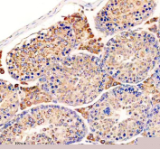 IHC staining of FFPE mouse testis tissue with UPF1 antibody, HRP-secondary and DAB substrate. HIER: boil tissue sections in pH8 EDTA for 20 min and allow to cool before testing.