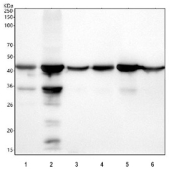 Western blot testing of 1) rat heart, 2) rat lung, 3) rat brain, 4) mouse heart, 5) mouse lung and 6) mouse brain tissue lysate using ACTA2 antibody. Predicted molecular weight ~42 kDa.