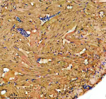 IHC staining of FFPE zebrafish heart tissue with Zebrafish ILK antibody. HIER: boil tissue sections in pH8 EDTA for 20 min and allow to cool before testing.