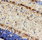 IHC staining of FFPE zebrafish brain tissue with Zebrafish ILK antibody. HIER: boil tissue sections in pH8 EDTA for 20 min and allow to cool before testing.