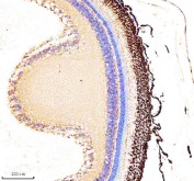 IHC staining of FFPE zebrafish retina tissue with Zebrafish Actin-related protein 2 antibody. HIER: boil tissue sections in pH8 EDTA for 20 min and allow to cool before testing.