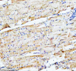 IHC staining of FFPE zebrafish skeletal muscle tissue with Zebrafish Actin-related protein 2 antibody. HIER: boil tissue sections in pH8 EDTA for 20 min and allow to cool before testing.