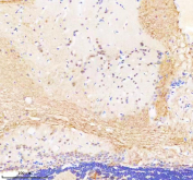 Immunohistochemical analysis of Bap1 protein using Zebrafish Bap1 antibody and paraffin-embedded zebrafish brain tissue. HIER: boil tissue sections in pH8 EDTA for 20 min and allow to cool before testing.