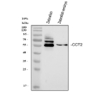 Western blot analysis of Zebrafish Cct2 protein using Zebrafish Cct2 antibody and 1) whole zebrafish and 2) zebrafish embryo lysate. Predicted molecular weight ~58 kDa.