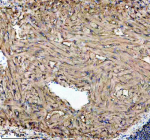 IHC staining of FFPE zebrafish heart tissue with Zebrafish Gls antibody. HIER: boil tissue sections in pH8 EDTA for 20 min and allow to cool before testing.
