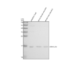 Western blot analysis of Srsf3a/b protein using Zebrafish Srsf3 antibody and 1) zebrafish head, 2) whole female zebrafish and 3) whole male zebrafish tissue lysate. Predicted molecular weight: 19-20 kDa.