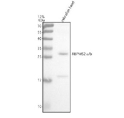 Western blot analysis of Rbpms2a/b protein using Zebrafish Rbpms2 antibody and zebrafish head tissue lysate. The predicted molecular weight of Rbpms2a/b is ~22 kDa.