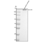 Western blot analysis of Dicer protein using Zebrafish Dicer antibody and zebrafish embryo tissue lysate. The predicted molecular weight of Dicer is ~219 kDa.