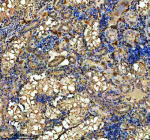 IHC staining of FFPE zebrafish kidney tissue with Zebrafish Hprt1 antibody. HIER: boil tissue sections in pH8 EDTA for 20 min and allow to cool before testing.