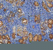 IHC staining of FFPE zebrafish kidney tissue with Zebrafish Abce1 antibody, HRP-secondary and DAB substrate. HIER: boil tissue sections in pH8 EDTA for 20 min and allow to cool before testing.
