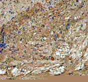 IHC staining of FFPE zebrafish brain tissue with Zebrafish Abce1 antibody. HIER: boil tissue sections in pH8 EDTA for 20 min and allow to cool before testing.
