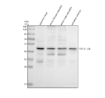 Western blot analysis of TSG101a/b protein using Zebrafish Tsg101 antibody and 1) zebrafish head, 2) whole female zebrafish, 3) whole male zebrafish and 4) zebrafish embryo tissue lysate. Predicted molecular weight ~44 kDa.
