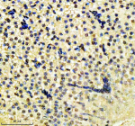 IHC staining of FFPE zebrafish liver tissue with Zebrafish H2ax antibody, HRP secondary and DAB substrate. HIER: boil tissue sections in pH8 EDTA for 20 min and allow to cool before testing.