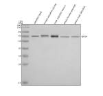 Western blot analysis of Kif3a protein using Zebrafish Kif3a antibody and 1) zebrafish head, 2) female zebrafish viscera, 3) male zebrafish viscera, 4) whole female zebrafish and 5) whole male zebrafish tissue lysate. Predicted molecular weight ~80 kDa commonly observed at 70-80 kDa.