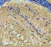 IHC staining of FFPE zebrafish brain tissue with Zebrafish Dlst antibody, HRP secondary and DAB substrate. HIER: boil tissue sections in pH8 EDTA for 20 min and allow to cool before testing.