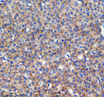 IHC staining of FFPE zebrafish liver tissue with Zebrafish Dlst antibody, HRP secondary and DAB substrate. HIER: boil tissue sections in pH8 EDTA for 20 min and allow to cool before testing.