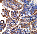 Immunohistochemical analysis of Ttc7b protein using Zebrafish Ttc7b antibody, HRP secondary and DAB substrate with paraffin-embedded zebrafish colon tissue. HIER: boil tissue sections in pH8 EDTA for 20 min and allow to cool before testing.