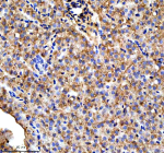 Immunohistochemical analysis of Ttc7b protein using Zebrafish Ttc7b antibody, HRP secondary and DAB substrate with paraffin-embedded zebrafish liver tissue. HIER: boil tissue sections in pH8 EDTA for 20 min and allow to cool before testing.