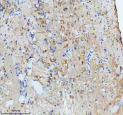 IHC staining of FFPE zebrafish brain tissue with Zebrafish Cct4 antibody, HRP secondary and DAB substrate. HIER: boil tissue sections in pH8 EDTA for 20 min and allow to cool before testing.