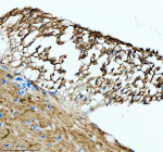 IHC staining of zebrafish Luteinizing hormone beta protein using Zebrafish Luteinizing hormone beta antibody, HRP-labeled secondary and DAB substrate. Luteinizing hormone beta was detected in a paraffin-embedded section of zebrafish hypophysis tissue. HIER: boil tissue sections in pH8 EDTA for 20 min and allow to cool before testing.