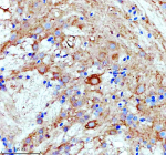 IHC staining of zebrafish Luteinizing hormone beta protein using Zebrafish Luteinizing hormone beta antibody, HRP-labeled secondary and DAB substrate. Luteinizing hormone beta was detected in a paraffin-embedded section of zebrafish hypothalamus tissue. HIER: boil tissue sections in pH8 EDTA for 20 min and allow to cool before testing.