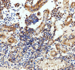 IHC staining of zebrafish Luteinizing hormone beta protein using Zebrafish Luteinizing hormone beta antibody, HRP-labeled secondary and DAB substrate. Luteinizing hormone beta was detected in a paraffin-embedded section of zebrafish kidney tissue. HIER: boil tissue sections in pH8 EDTA for 20 min and allow to cool before testing.