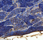 IHC staining of zebrafish Tgfb1 protein using Zebrafish Tgfb1 antibody, HRP-labeled secondary and DAB substrate. Tgfb1 was detected in a paraffin-embedded section of zebrafish testis tissue. HIER: boil tissue sections in pH8 EDTA for 20 min and allow to cool before testing.