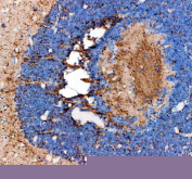 IHC staining of FFPE zebrafish eye tissue with Zebrafish Fshb antibody, HRP-labeled secondary and DAB substrate. HIER: boil tissue sections in pH8 EDTA for 20 min and allow to cool before testing.