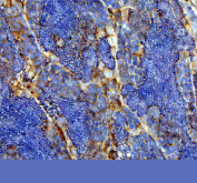 IHC staining of zebrafish Flt1 protein using Zebrafish Flt1 antibody, HRP-labeled secondary and DAB substrate. Flt1 was detected in a paraffin-embedded section of zebrafish testis tissue. HIER: boil tissue sections in pH8 EDTA for 20 min and allow to cool before testing.