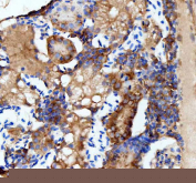 IHC staining of zebrafish Flt1 protein using Zebrafish Flt1 antibody, HRP-labeled secondary and DAB substrate. Flt1 was detected in a paraffin-embedded section of zebrafish kidney tissue. HIER: boil tissue sections in pH8 EDTA for 20 min and allow to cool before testing.