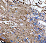 IHC staining of zebrafish Flt1 protein using Zebrafish Flt1 antibody, HRP-labeled secondary and DAB substrate. Flt1 was detected in a paraffin-embedded section of zebrafish spinal cord tissue. HIER: boil tissue sections in pH8 EDTA for 20 min and allow to cool before testing.