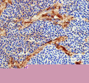 IHC staining of zebrafish Flt1 protein using Zebrafish Flt1 antibody, HRP-labeled secondary and DAB substrate. Flt1 was detected in a paraffin-embedded section of zebrafish heart tissue. HIER: boil tissue sections in pH8 EDTA for 20 min and allow to cool before testing.