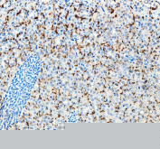 IHC staining of zebrafish Lhcgr protein using Zebrafish Lhcgr antibody, HRP-labeled secondary and DAB substrate. Lhcgr was detected in a paraffin-embedded section of zebrafish kidney tissue. HIER: boil tissue sections in pH8 EDTA for 20 min and allow to cool before testing.