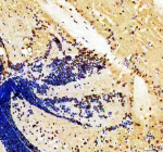 IHC staining of zebrafish Her4 protein using Zebrafish Her4 antibody. Her4 was detected in a paraffin-embedded section of zebrafish brain tissue. HIER: boil tissue sections in pH8 EDTA for 20 min and allow to cool before testing.