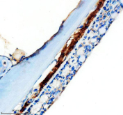 IHC staining of FFPE zebrafish skin tissue with Zebrafish Mmp13a antibody, HRP-labeled secondary and DAB substrate. HIER: boil tissue sections in pH8 EDTA for 20 min and allow to cool before testing.