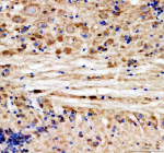 IHC staining of FFPE zebrafish brain tissue with Zebrafish Hsd3b1 antibody, HRP-labeled secondary and DAB substrate. HIER: boil tissue sections in pH8 EDTA for 20 min and allow to cool before testing.