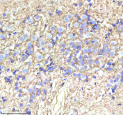 IHC staining of FFPE zebrafish brain tissue with Zebrafish Alcama antibody, HRP-labeled secondary and DAB substrate. HIER: boil tissue sections in pH8 EDTA for 20 min and allow to cool before testing.