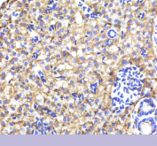 IHC staining of FFPE zebrafish liver tissue with Zebrafish Alcama antibody, HRP-labeled secondary and DAB substrate. HIER: boil tissue sections in pH8 EDTA for 20 min and allow to cool before testing.