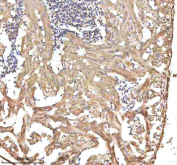 IHC staining of FFPE zebrafish heart tissue with Zebrafish Alcama antibody, HRP-labeled secondary and DAB substrate. HIER: boil tissue sections in pH8 EDTA for 20 min and allow to cool before testing.
