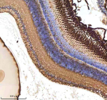 IHC staining of zebrafish Atoh7 protein using Zebrafish Atoh7 antibody, HRP-labeled secondary and DAB substrate. Atoh7 was detected in a paraffin-embedded section of zebrafish eye tissue. HIER: boil tissue sections in pH8 EDTA for 20 min and allow to cool before testing.