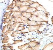 IHC staining of FFPE zebrafish muscle tissue with Zebrafish Bmp2b antibody, HRP-labeled secondary and DAB substrate. HIER: boil tissue sections in pH8 EDTA for 20 min and allow to cool before testing.