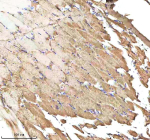 IHC staining of FFPE zebrafish muscle tissue with Zebrafish Caspase 9 antibody, HRP-labeled secondary and DAB substrate. HIER: boil tissue sections in pH8 EDTA for 20 min and allow to cool before testing.