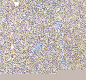 IHC staining of FFPE zebrafish liver tissue with Zebrafish Caspase 9 antibody, HRP-labeled secondary and DAB substrate. HIER: boil tissue sections in pH8 EDTA for 20 min and allow to cool before testing.