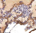 IHC staining of zebrafish Cxcl12 protein using Zebrafish Cxcl12 antibody, HRP-labeled secondary and DAB substrate. Cxcl12 was detected in a paraffin-embedded section of zebrafish heart tissue. HIER: boil tissue sections in pH8 EDTA for 20 min and allow to cool before testing.