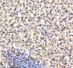 IHC staining of zebrafish Cyp17a1 protein using Zebrafish Cyp17a1 antibody, HRP-labeled secondary and DAB substrate. Cyp17a1 was detected in a paraffin-embedded section of zebrafish liver tissue. HIER: boil tissue sections in pH8 EDTA for 20 min and allow to cool before testing.