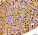 IHC staining of FFPE zebrafish liver tissue with Zebrafish Dnm1 antibody, HRP-labeled secondary and DAB substrate. HIER: boil tissue sections in pH8 EDTA for 20 min and allow to cool before testing.